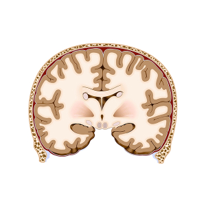 corte coronal del cerebro
