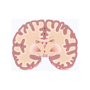 corte cerebral frontal