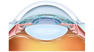 anatomy of the eye and aqueous humor