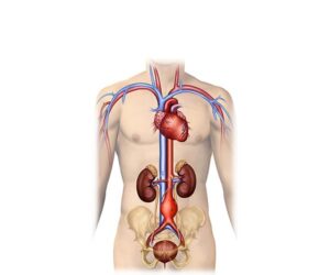 aneurisma abdominal