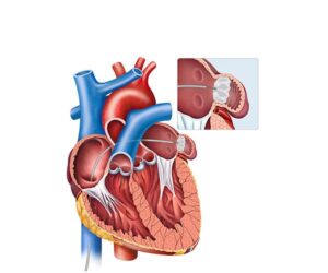 apendice del corazon y detalle