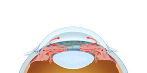 aqueous humor drainage in glaucoma