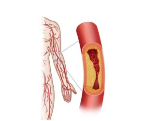 arterias brazo