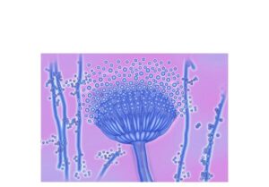 aspergillus filamentoso