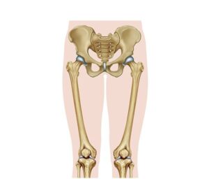 cadera y femur