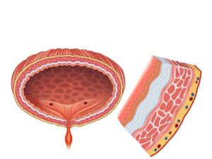 capas vesical