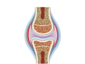 cartilago rodilla normal