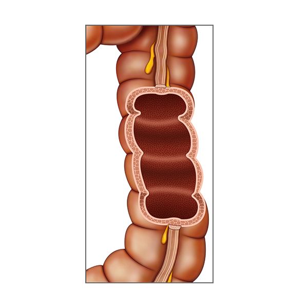 colon descendente colon descendente