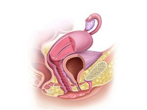 conjunto de útero y vagina