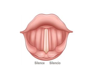 cuerdas vocales en silencio