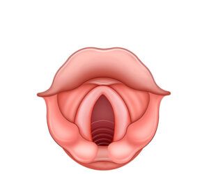 cuerdas vocales inflamadas