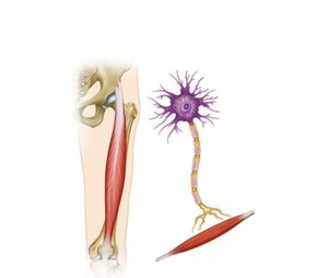debilitamiento muscular en esclerosis