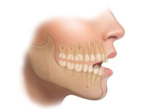 dentadura humana