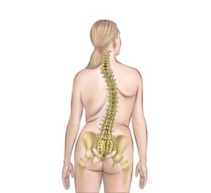 escoliosis vertebral