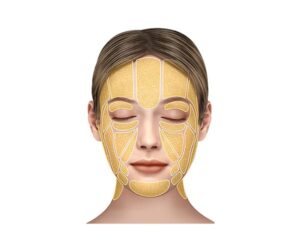 facial fat