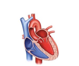 insuficiencia valvular aórtica