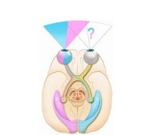 vista inferior del cerebro