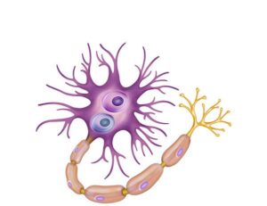 la neurona los cuerpos de lewy