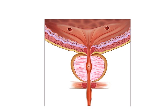 la prostata la prostata
