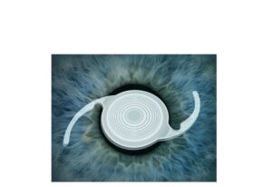 lens of the artificial eye