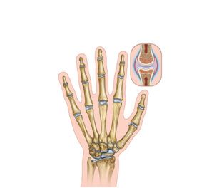 morphology of the hand