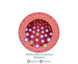 niveles altos de glucosa