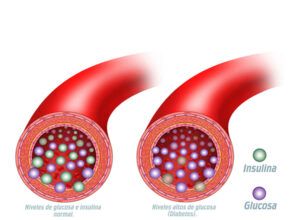 niveles de insulina y glucosa