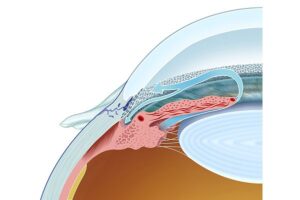 normal aqueous drainage of the eye