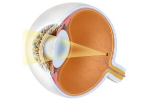 normal focus of the eye