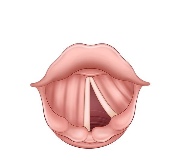 paralysis paralysis