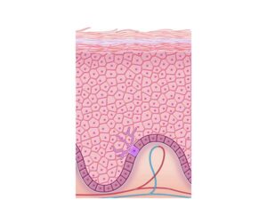 queratinización epidérmica