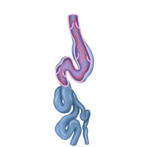 realistic scheme of varicose veins