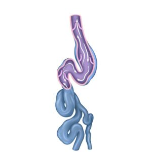 representacion realista de varices
