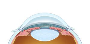 schlemm's ocular canal