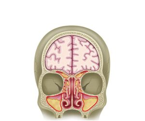 seccion paranasal frontal inflamada