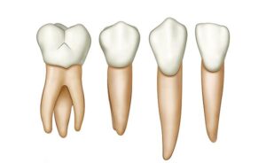 tipos de dientes