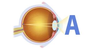 visión normal del ojo