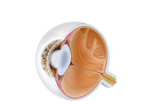 vitreous detachment