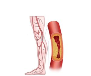 arterias pierna
