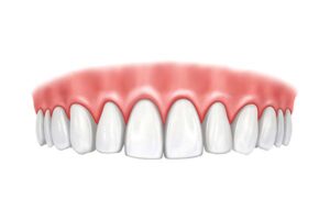 dentadura