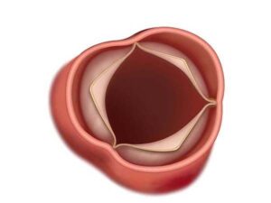 la valvula aortica abierta