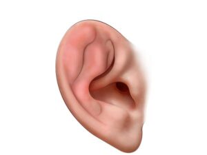 oreja con pericondritis