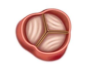 valvula aortica cerrada