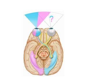 vista inferior del cerebro