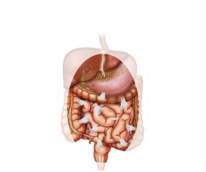 adhesion abdominal