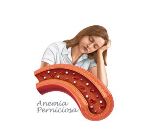 anemia perniciosa