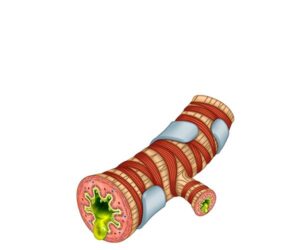 bronquiolo bronquitis