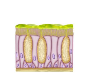 celulas mucuosas alteradas