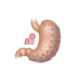 deficiencia de vitamina b12 en anemia perniciosa