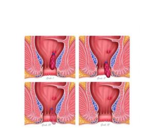 ilusmedical.com